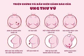 Ung thư vú không còn là “án tử” nếu được phát hiện sớm